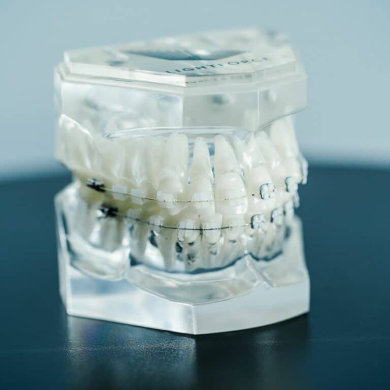 Clear braces at Harmony Orthodontics in Canton, GA